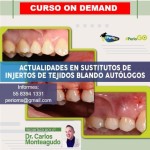 Actualidades en sustitutos de ingertos de tejido blando autologos $USD 